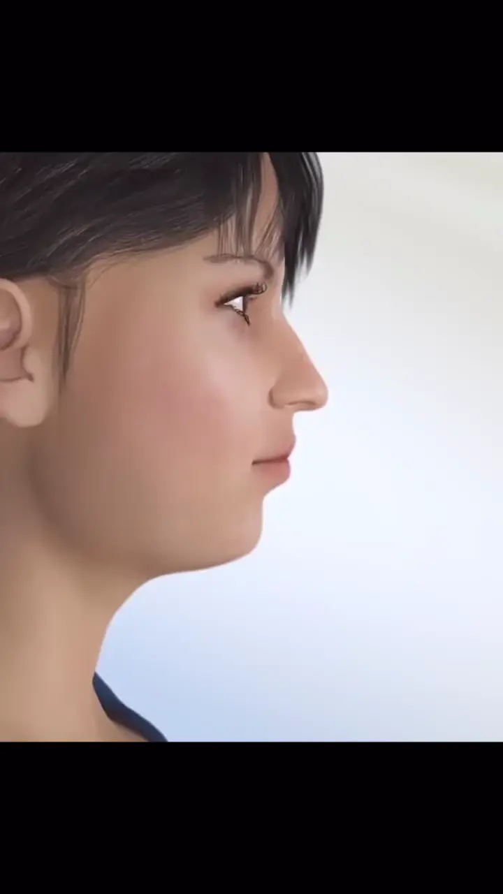 Planejamento virtual 3D do perfil facial usado na cirurgia ortognática