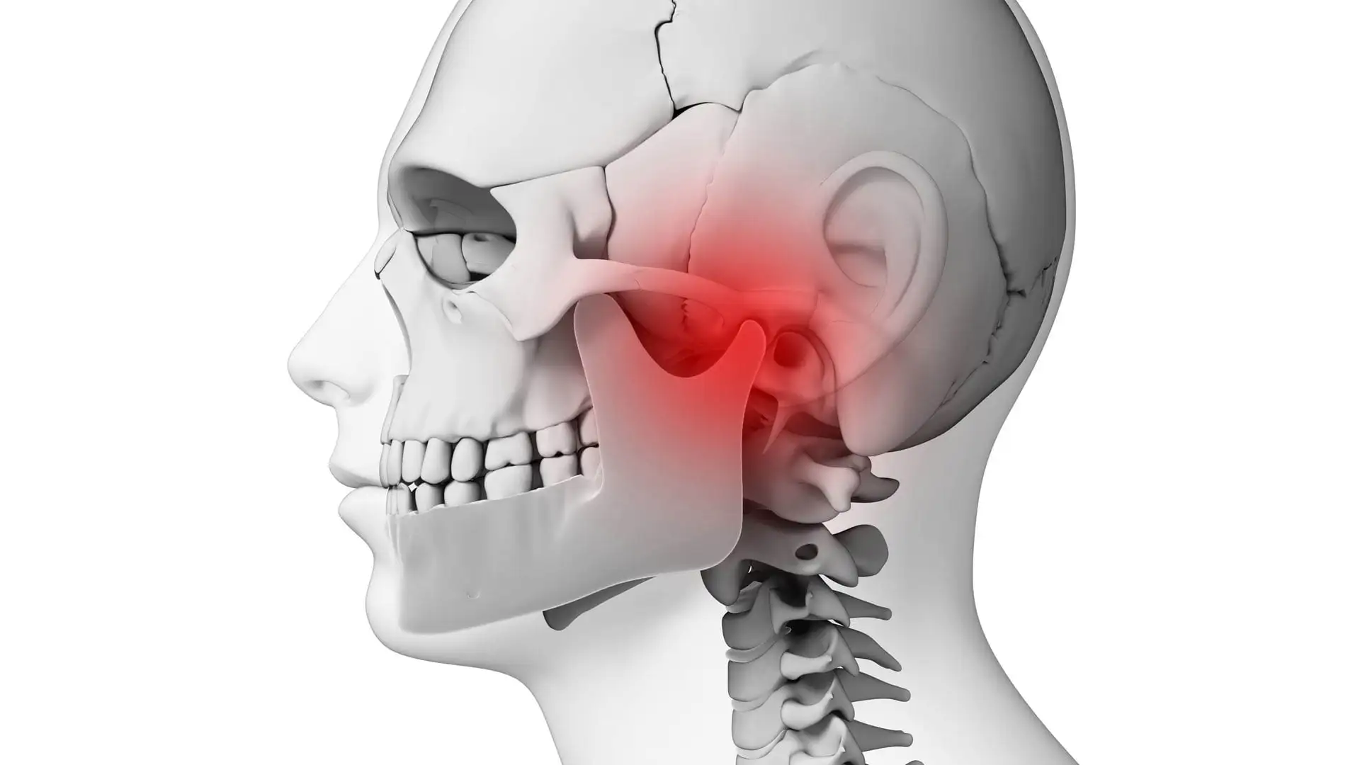 Anatomia da articulação temporomandibular (ATM) — ilustração 3D destacando a região de dor