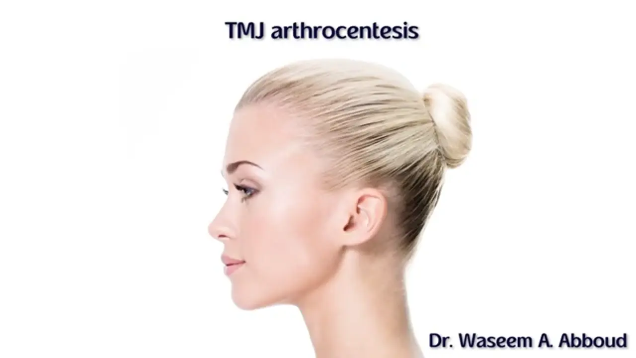 Animação 3D da lavagem da articulação temporomandibular